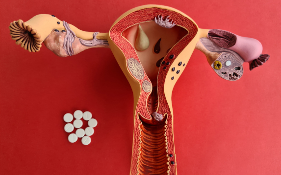 Bowel Endometriosis Treatment