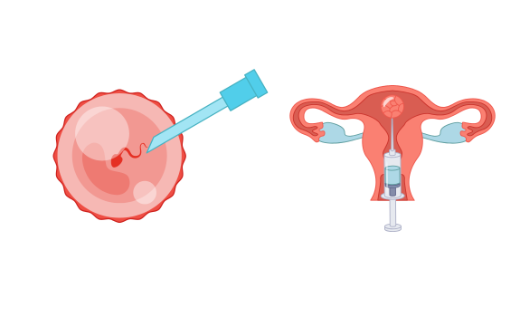 Embryo Donation