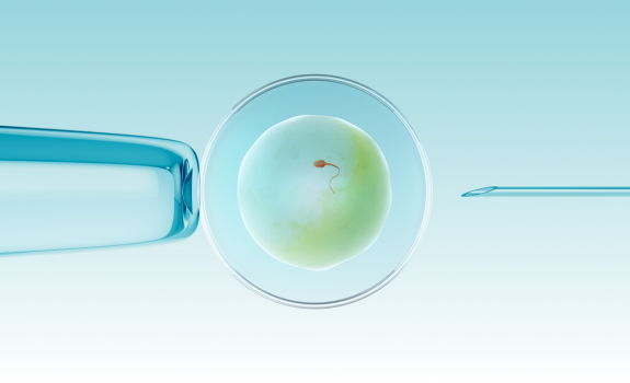 ICSI (Intracytoplasmic Sperm Injection)