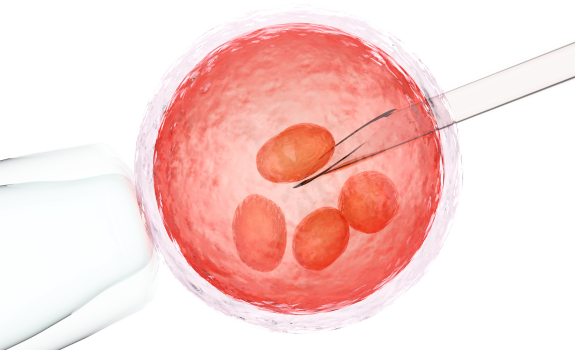 IUI (Intrauterine Insemination)