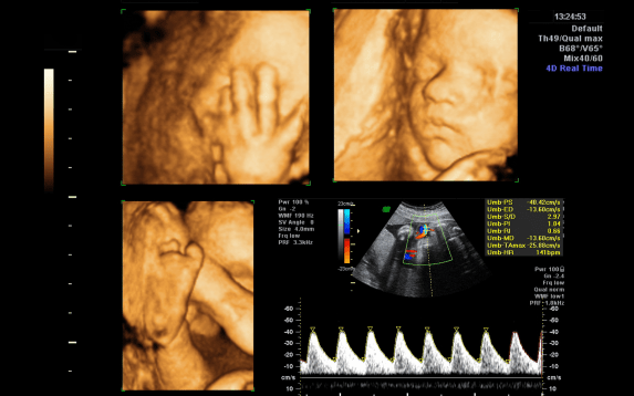 Anomaly scan in Palanpur