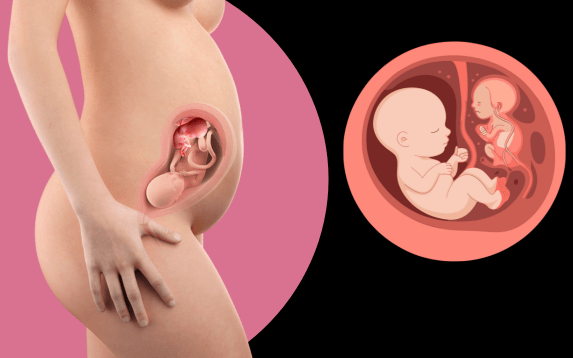 Fetal Therapy & Interventions in palanpur