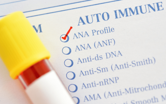 ANA Test in Palanpur