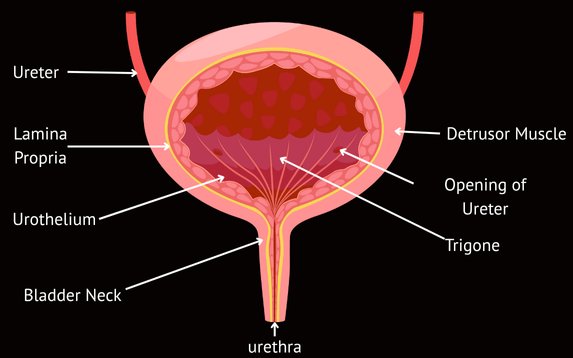 Advanced Endometriosis Care Palanpur