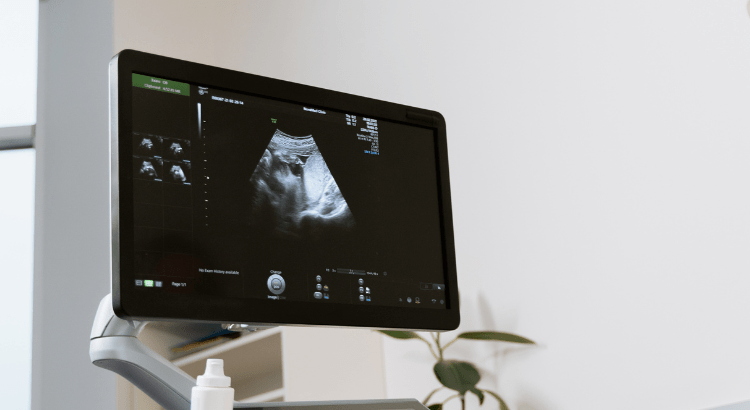 Fetal-medicine-center Gynecology at Isha IVF Centre