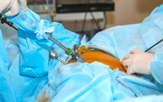 Invasive diagnostic procedures in Palanpur