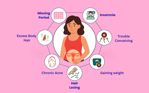 Understanding PCOS-1