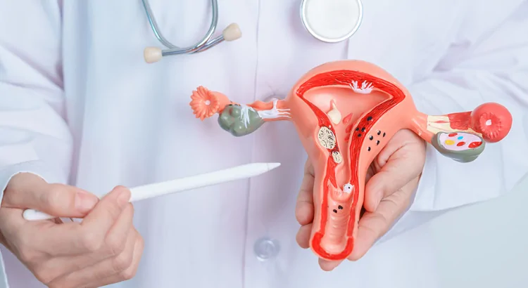 Best Gynecologist for Endometriosis in Palanpur