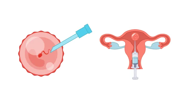 Embryo Donation in Palanpur